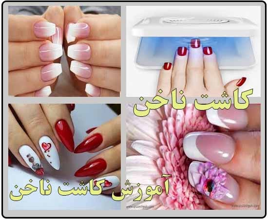 کاشت ناخن